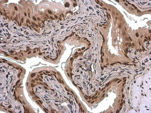 ARID5A Antibody in Immunohistochemistry (Paraffin) (IHC (P))