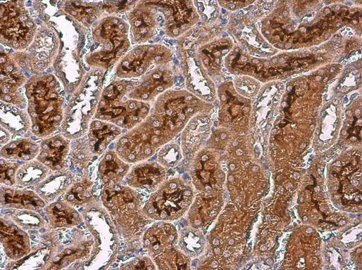 Arginase 2 Antibody in Immunohistochemistry (Paraffin) (IHC (P))