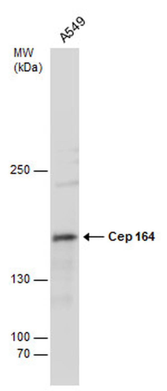 CEP164 Antibody in Western Blot (WB)