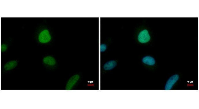 ENY2 Antibody in Immunocytochemistry (ICC/IF)