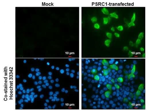 PSRC1 Antibody in Immunocytochemistry (ICC/IF)