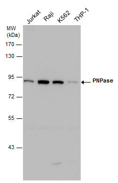 PNPase Antibody in Western Blot (WB)