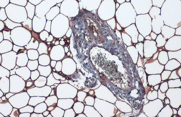 Perilipin 1 Antibody in Immunohistochemistry (Paraffin) (IHC (P))