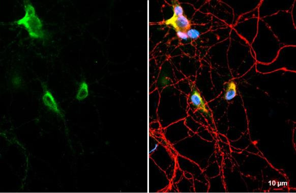 C9orf72 Antibody in Immunocytochemistry (ICC/IF)