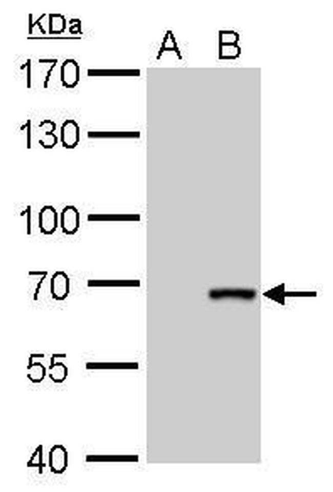 Cre recombinase Antibody in Western Blot (WB)
