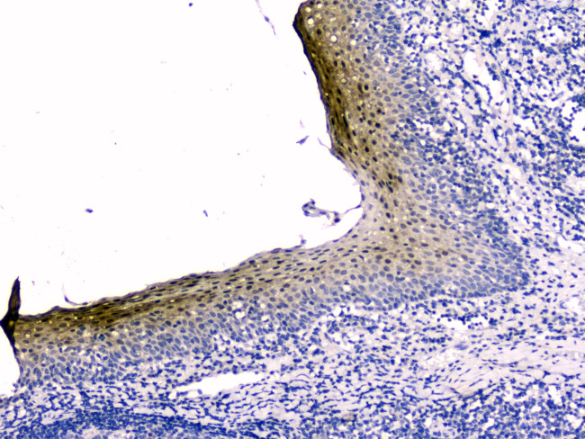 Cystatin B Antibody in Immunohistochemistry (Paraffin) (IHC (P))