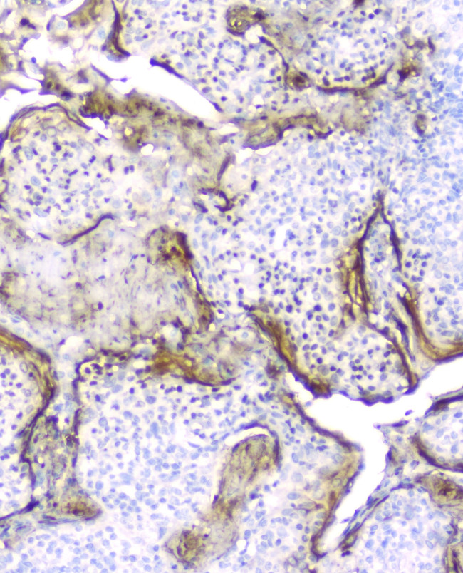 PI3 Antibody in Immunohistochemistry (Paraffin) (IHC (P))