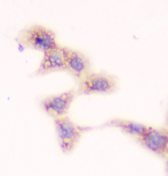 SMN1/SMN2 Antibody in Immunocytochemistry (ICC/IF)