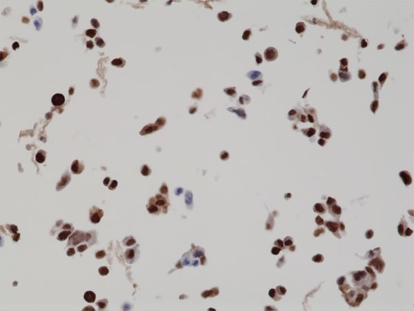 BAG1L Antibody in Immunocytochemistry (ICC/IF)