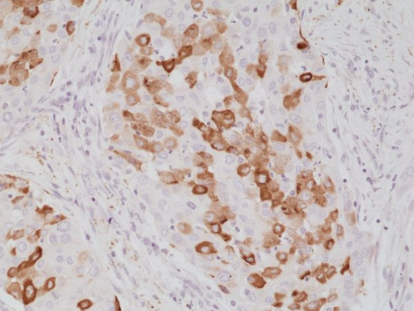 SFTPA1 Antibody in Immunohistochemistry (Paraffin) (IHC (P))