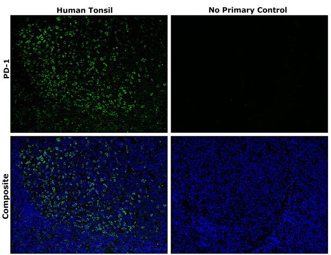 PD-1 (CD279) Antibody in Immunohistochemistry (Paraffin) (IHC (P))