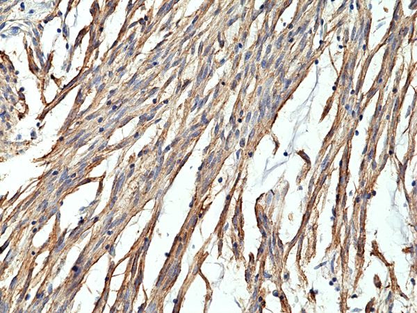 CD34 Antibody in Immunohistochemistry (Paraffin) (IHC (P))