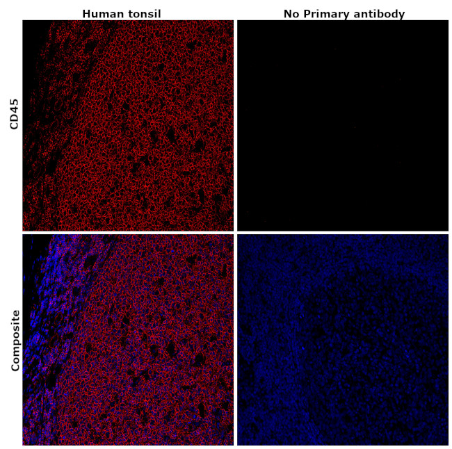 CD45 Antibody in Immunohistochemistry (Paraffin) (IHC (P))