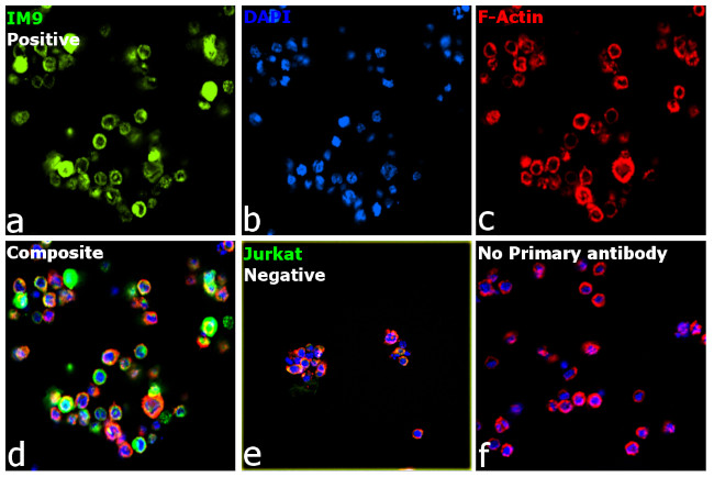 Human Ig (Light chain) Secondary Antibody in Immunocytochemistry (ICC/IF)