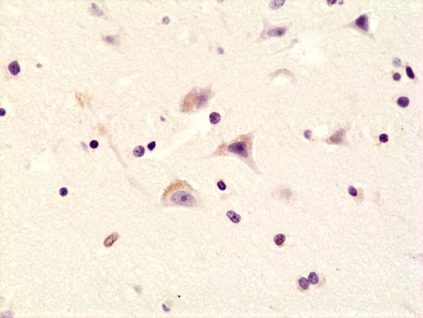 Phospho-GluR1 (Ser845) Antibody in Immunohistochemistry (Paraffin) (IHC (P))