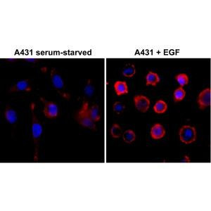 Phosphotyrosine Antibody in Immunocytochemistry (ICC/IF)