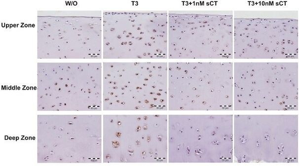 Calcitonin Receptor Antibody in Immunohistochemistry (Paraffin) (IHC (P))