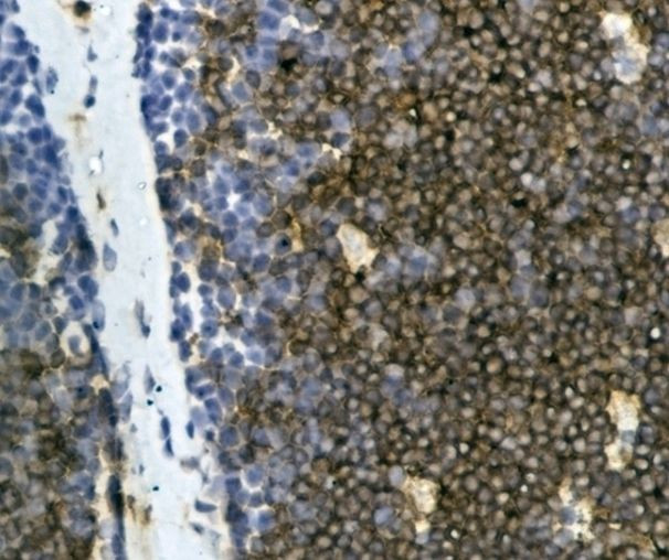 CD4 Antibody in Immunohistochemistry (Frozen) (IHC (F))