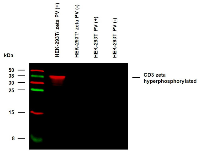 Phospho-CD247 (CD3 zeta) (Tyr153) Antibody in Western Blot (WB)
