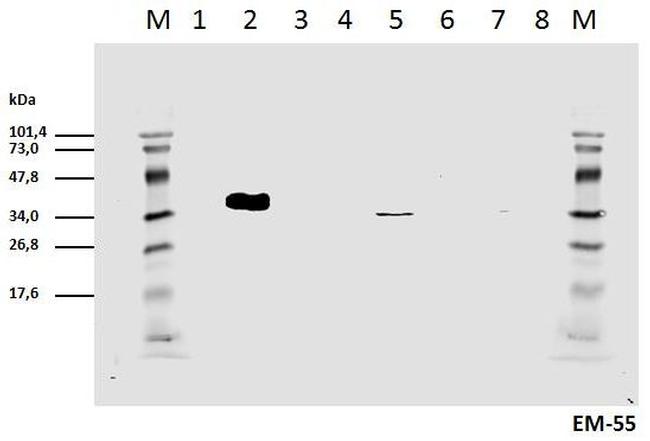 Phospho-CD247 (CD3 zeta) (Tyr111, Tyr123) Antibody in Western Blot (WB)