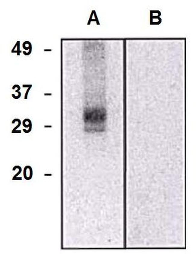 CLIC5 Antibody in Western Blot (WB)