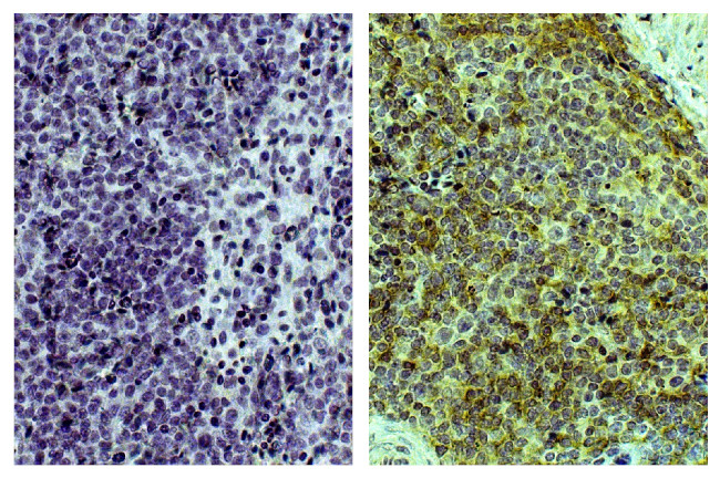 Bu-1 Antibody in Immunohistochemistry (Paraffin) (IHC (P))