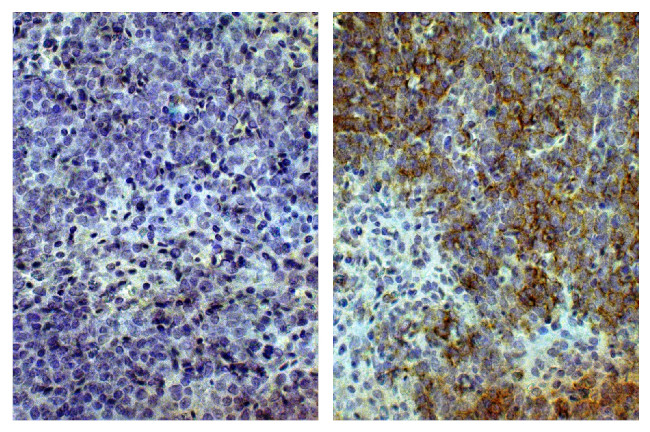 CD8 alpha Antibody in Immunohistochemistry (Paraffin) (IHC (P))