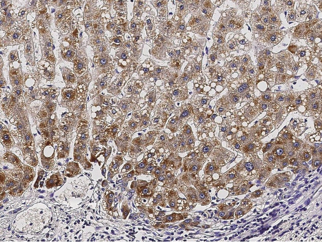 ACOX1 Antibody in Immunohistochemistry (Paraffin) (IHC (P))