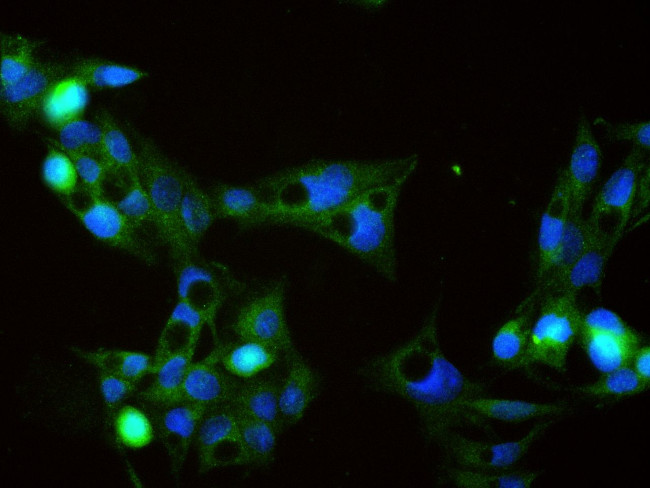 Angiotensinogen Antibody in Immunocytochemistry (ICC/IF)
