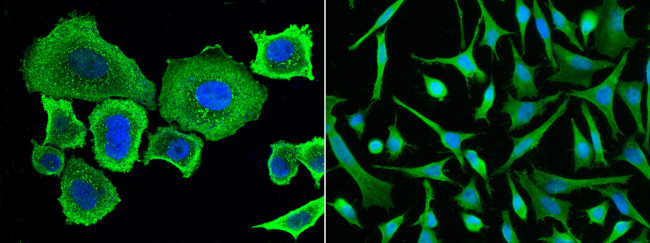 Angiotensinogen Antibody in Immunocytochemistry (ICC/IF)