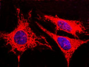 Adenylate Kinase 4 Antibody in Immunocytochemistry (ICC/IF)