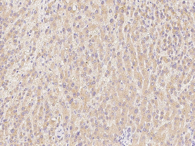 ASGR1 Antibody in Immunohistochemistry (Paraffin) (IHC (P))
