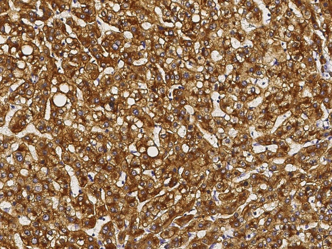 ASGR1 Antibody in Immunohistochemistry (Paraffin) (IHC (P))