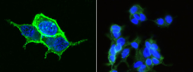 Carbonic Anhydrase XII Antibody in Immunocytochemistry (ICC/IF)