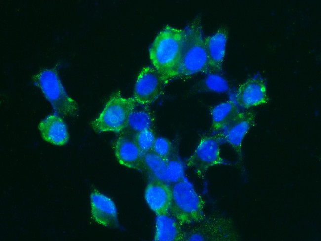 Carbonic Anhydrase XIV Antibody in Immunocytochemistry (ICC/IF)