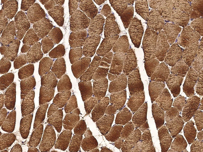 Carbonic Anhydrase III Antibody in Immunohistochemistry (Paraffin) (IHC (P))