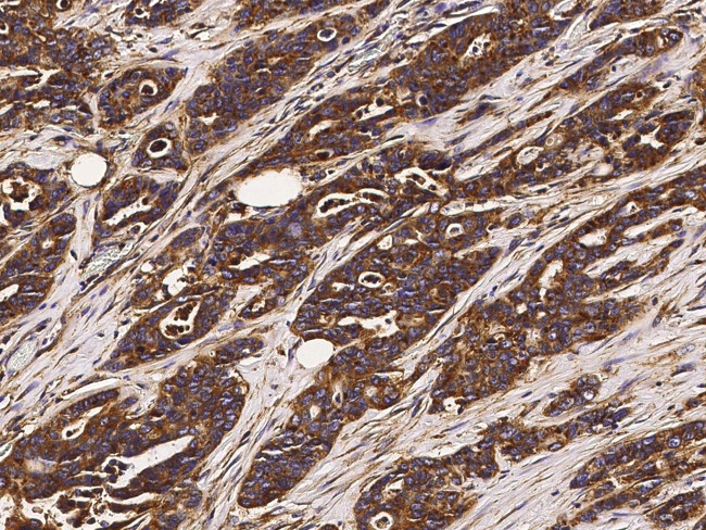 CD164 Antibody in Immunohistochemistry (Paraffin) (IHC (P))