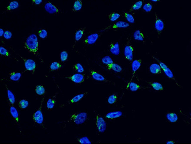 CHI3L2 Antibody in Immunocytochemistry (ICC/IF)