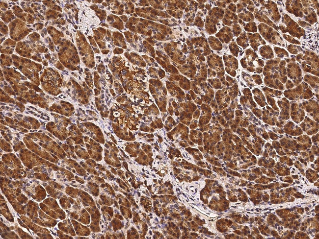 CLPS Antibody in Immunohistochemistry (Paraffin) (IHC (P))