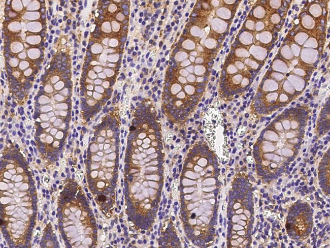 COMMD9 Antibody in Immunohistochemistry (Paraffin) (IHC (P))