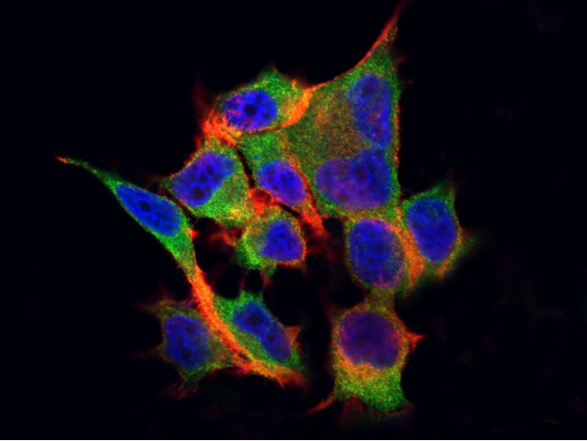 CSF3R Antibody in Immunocytochemistry (ICC/IF)