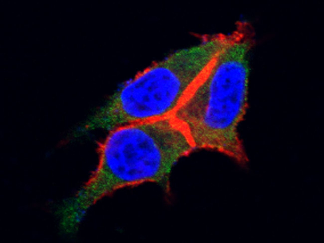 CSF3R Antibody in Immunocytochemistry (ICC/IF)