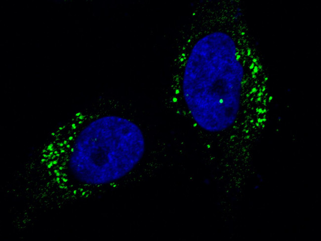 Cathepsin A Antibody in Immunocytochemistry (ICC/IF)