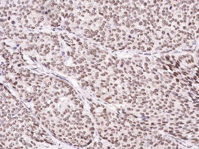 CUEDC2 Antibody in Immunohistochemistry (Paraffin) (IHC (P))