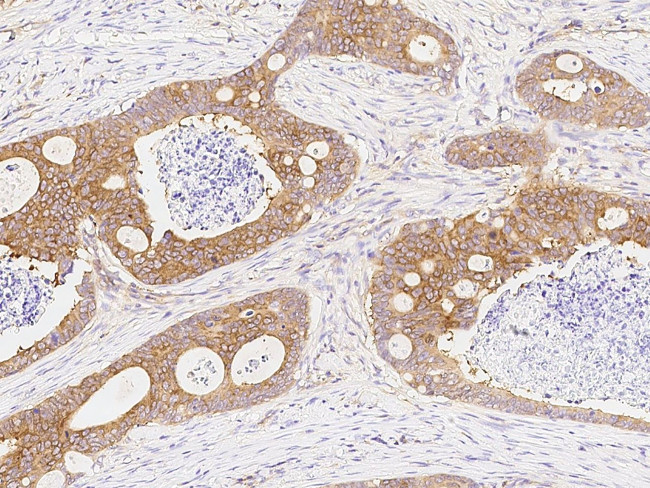 DARS Antibody in Immunohistochemistry (Paraffin) (IHC (P))