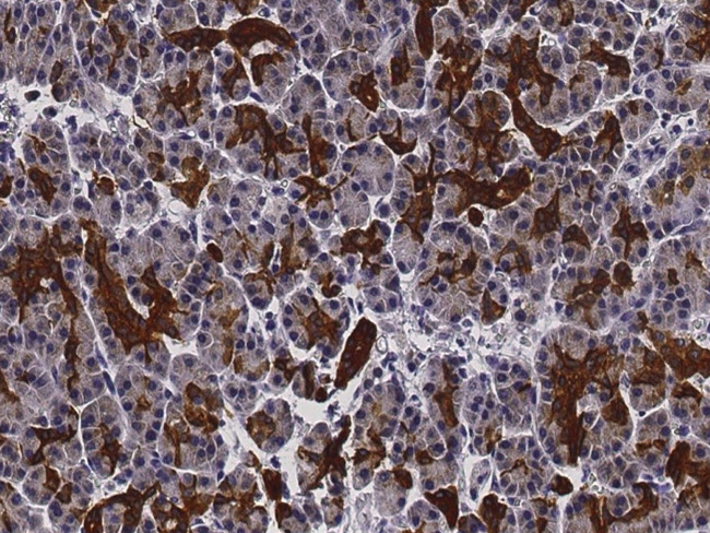 Ephrin A1 Antibody in Immunohistochemistry (Paraffin) (IHC (P))