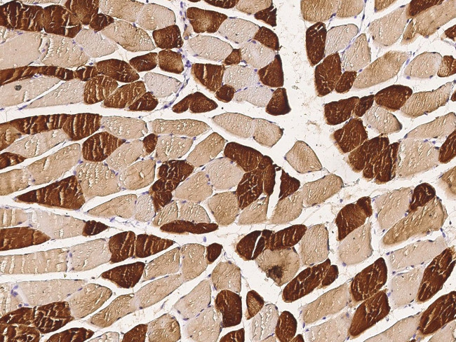 ENO3 Antibody in Immunohistochemistry (Paraffin) (IHC (P))