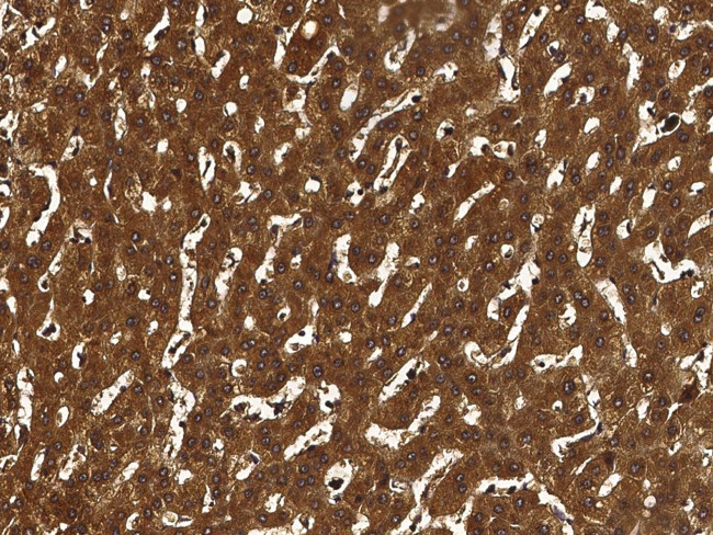 Factor X/Xa Antibody in Immunohistochemistry (Paraffin) (IHC (P))
