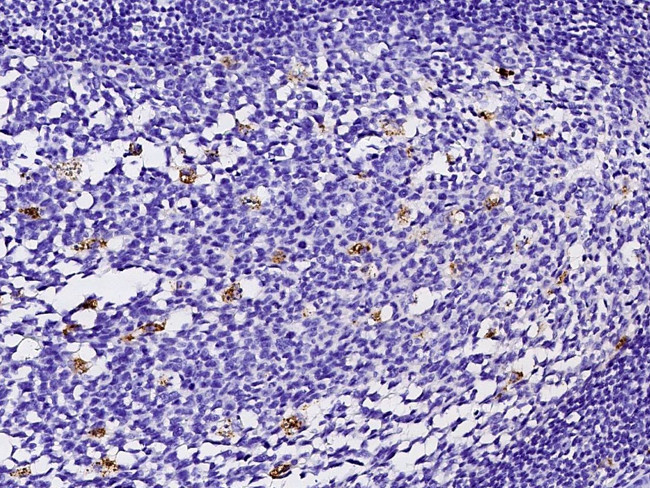 FABP4 Antibody in Immunohistochemistry (Paraffin) (IHC (P))