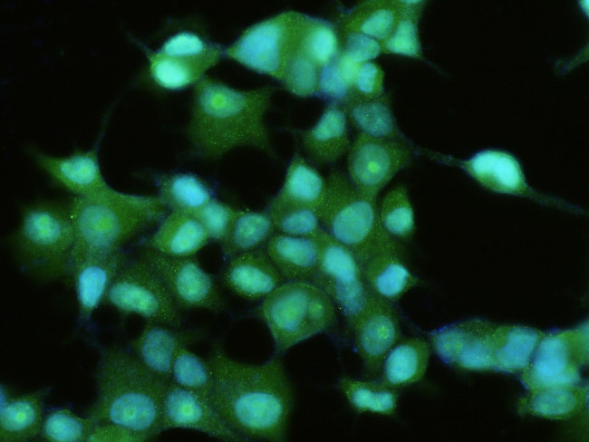 FABP6 Antibody in Immunocytochemistry (ICC/IF)